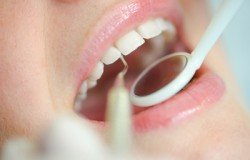 Dental Hygiene Cleanings Richmond Hill