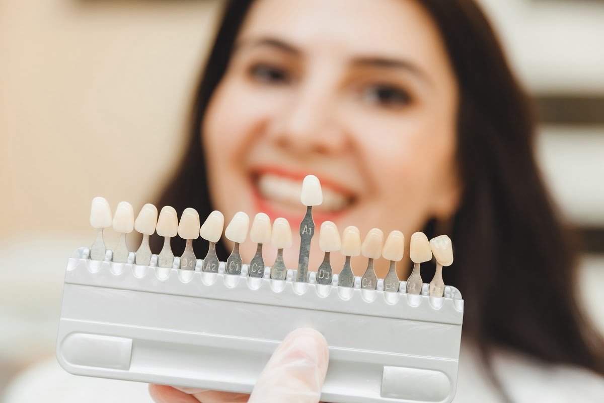 Cosmetic dentistry in Richmond Hill 1
