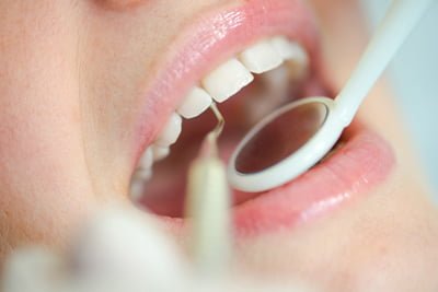 Periodontal Laser Treatments