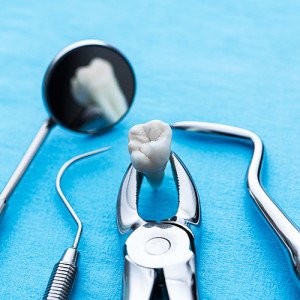 Wisdom Tooth Extraction