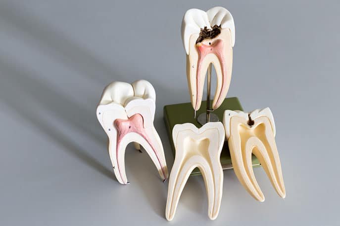 Dental Implantology