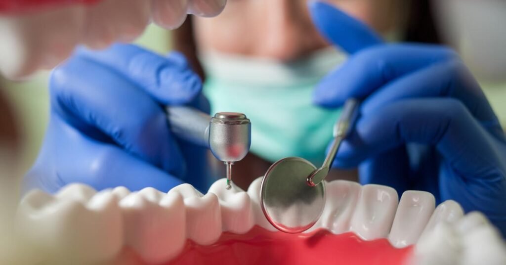full mouth dental implants