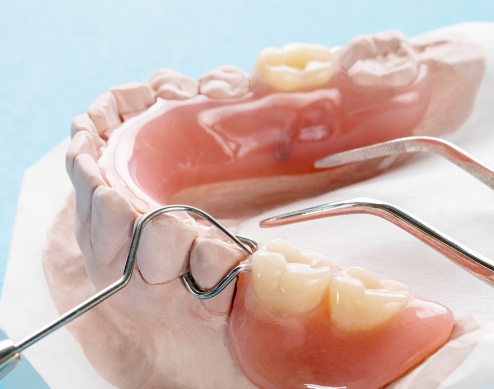 Pictures of partial dentures front teeth