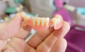 permanent partial denture