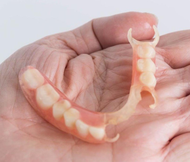 Partial Dentures Front Teeth