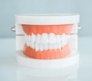 Pictures of partial dentures front teeth