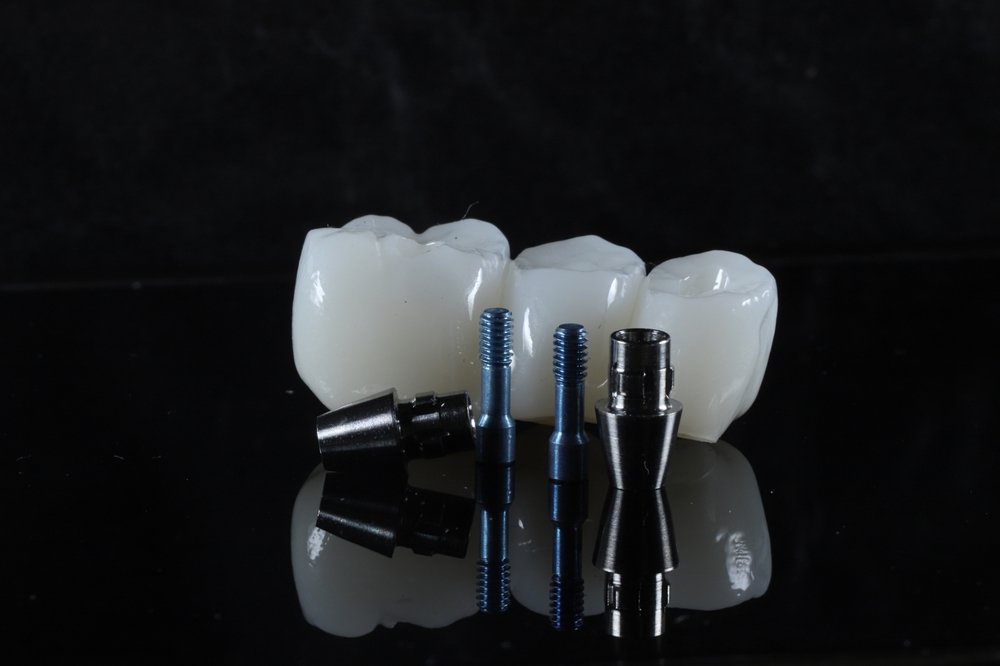 odsp cover dental implants