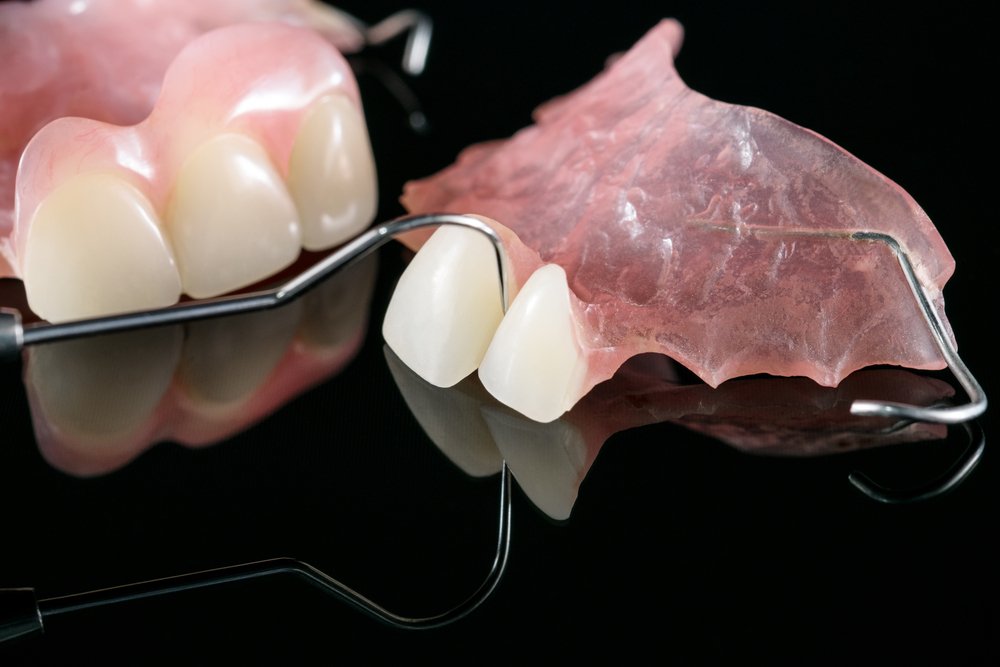 partial dentures for front teeth