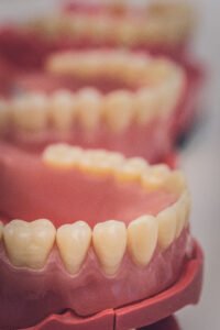 dentures vs veneers