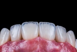 how much is a dental crown