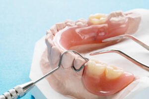 how long do partial dentures last