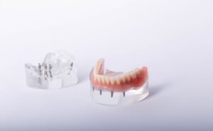 Implant dentures price