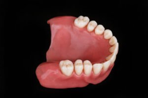 how should lower dentures fit