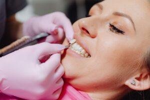 Woman receiving porcelain veneers for crooked teeth in Richmond Hill