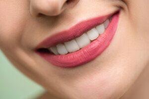 Close up of a bright smile in Richmond Hill