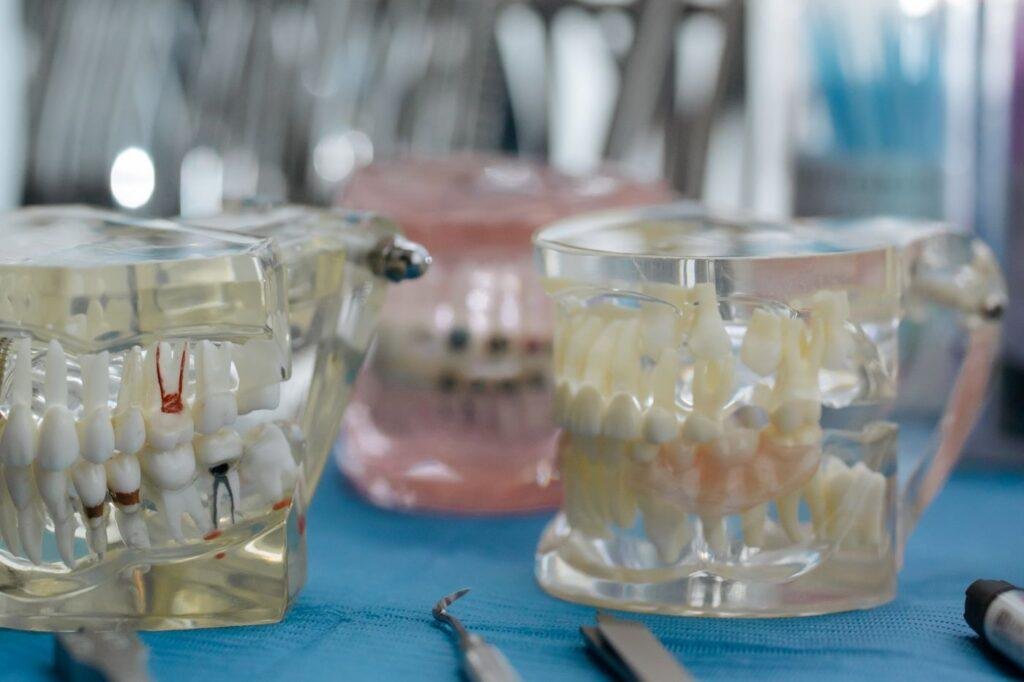 Dental models showing partial denture teeth arrangement