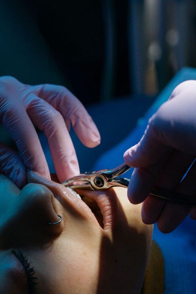 Dentist examining a patient with a grey discoloured tooth in Richmond Hill