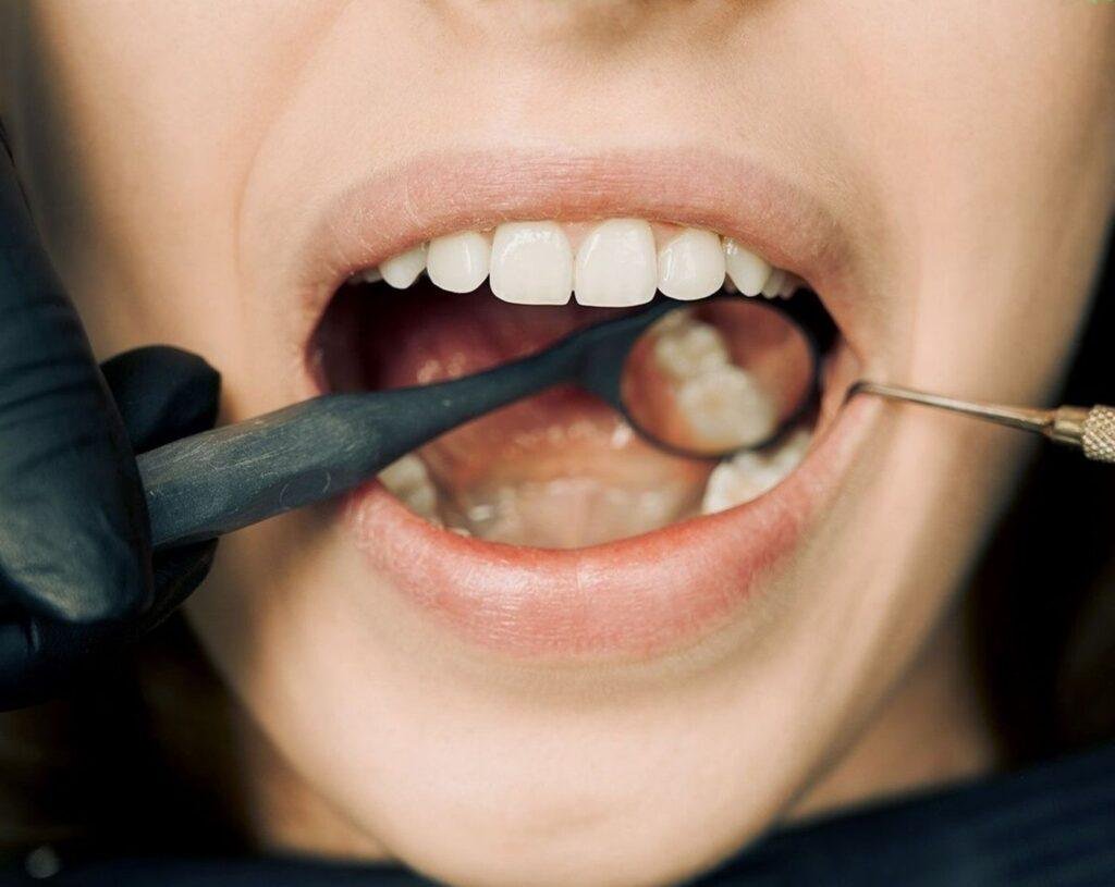 Dental examination with modern equipment for gum care