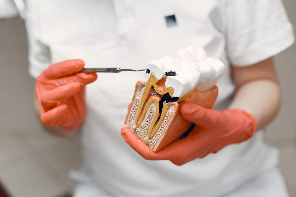 Dentist holding a tooth model to explain root canal treatment