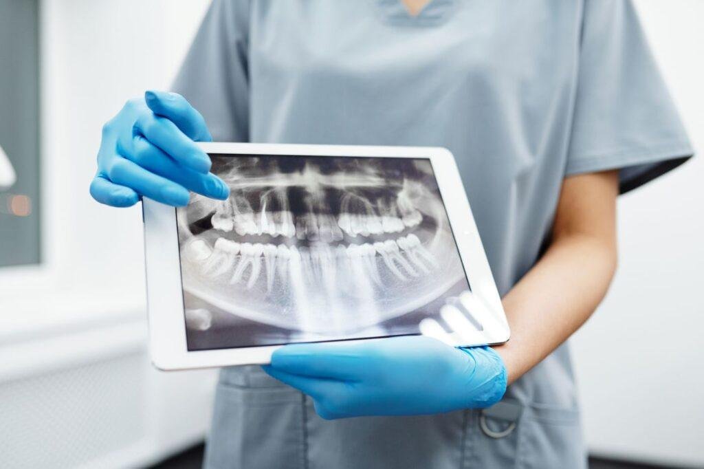 Dentist showing a dental X-ray on a tablet to diagnose an infected tooth