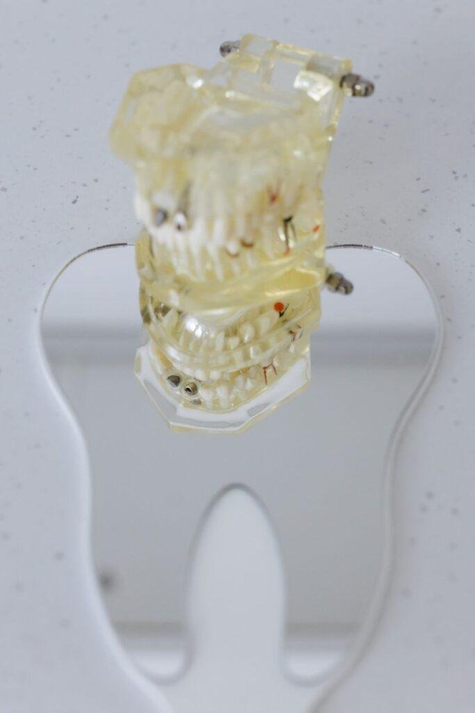 Why Is My Gum Swollen Around One Tooth?